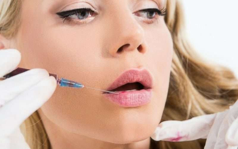 The Rise of Lip Filler Treatments The Rise of Lip Filler Treatments